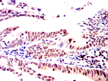 BMI1 Antibody