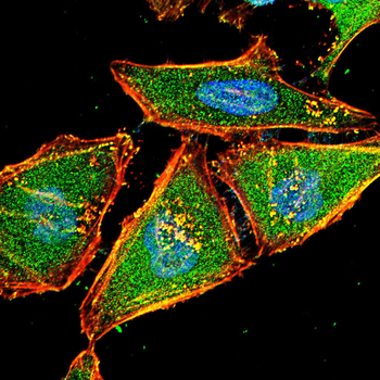 ALPL Antibody