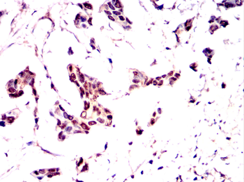 RPA1 Antibody