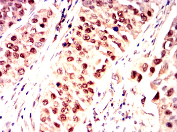 RPA1 Antibody
