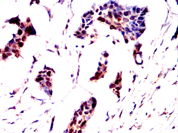MAPK8 Antibody