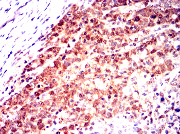 MAPK8 Antibody