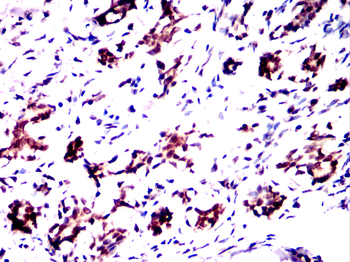 ARHGDIA Antibody