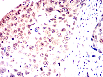 ARHGDIA Antibody