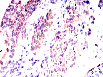 FOXP1 Antibody