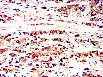 ITGB4 Antibody