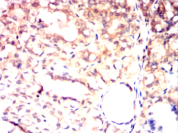 ITGB4 Antibody