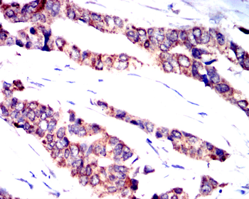 IL1B Antibody