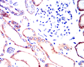 IL1B Antibody