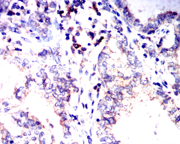 IL1B Antibody