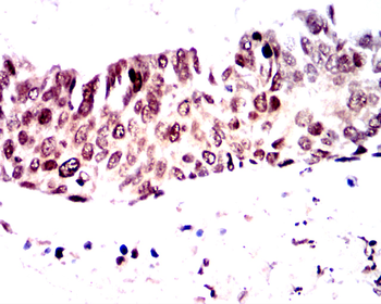 CCND1 Antibody