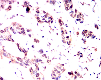 PPARA Antibody