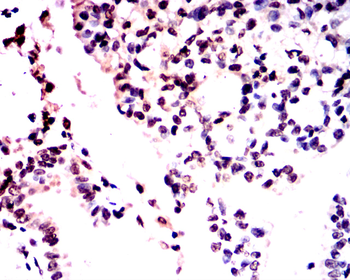 PPARA Antibody