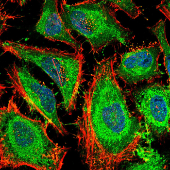 MyD88 Rabbit Polyclonal Antibody