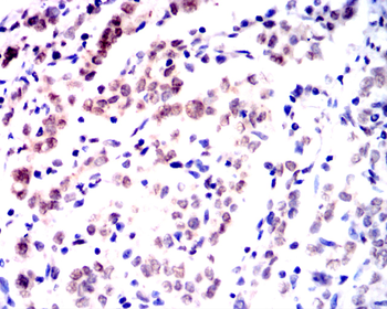 MyD88 Rabbit Polyclonal Antibody