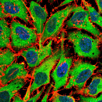 STAT1 Antibody