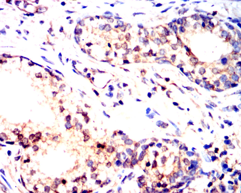 STAT1 Antibody