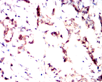 KIT Antibody