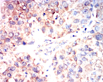 KIT Antibody