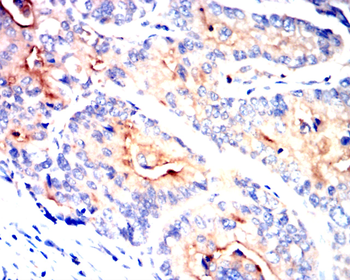 MAP2K1 Antibody