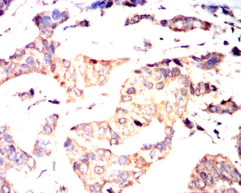 FAS Antibody