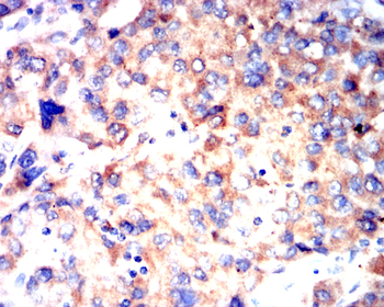 FAS Antibody