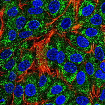 FGFR3 Antibody