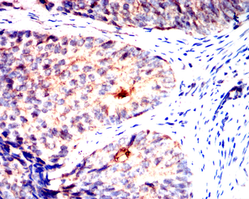 FGFR3 Antibody