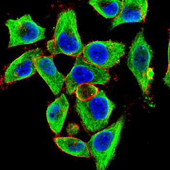 IL5 Antibody