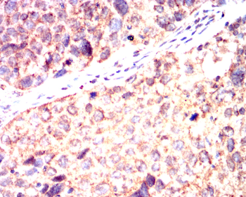 IL5 Antibody