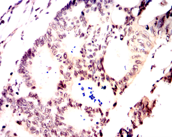 HSPB1 Antibody
