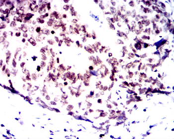 FGFR1 Antibody
