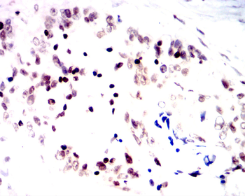 FGFR1 Antibody