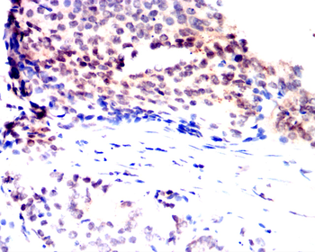 FGFR1 Antibody