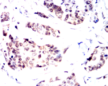 BAK1 Antibody