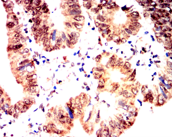 GATA1 Antibody