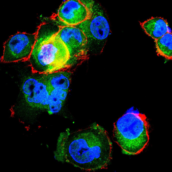 GPC3 Antibody