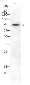 ALPP Antibody