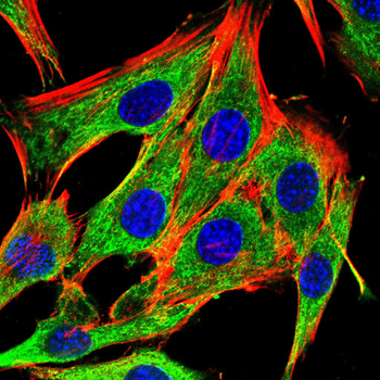 HK2 Antibody