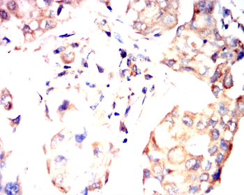 HK2 Antibody