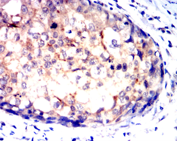 HK2 Antibody