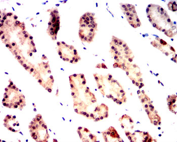 XRCC6 Antibody