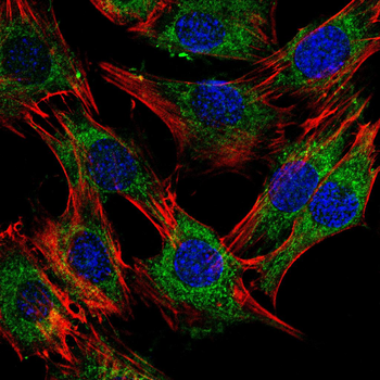 IL-6 Antibody