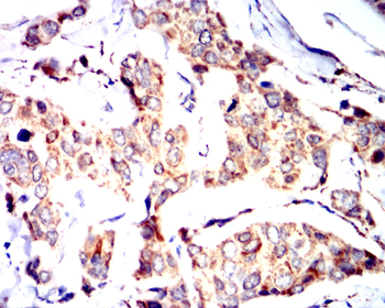 ALDH2 Antibody