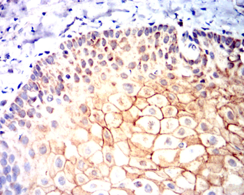 ALDH2 Antibody