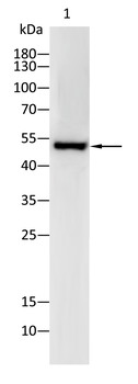 MMP1 Antibody