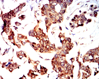 MMP1 Antibody