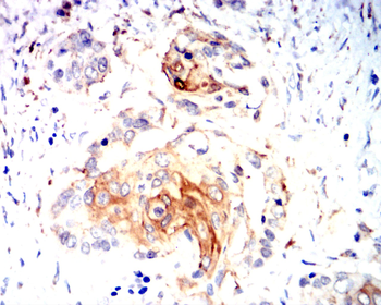 MMP1 Antibody