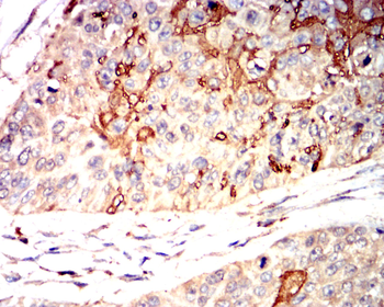 MMP1 Antibody