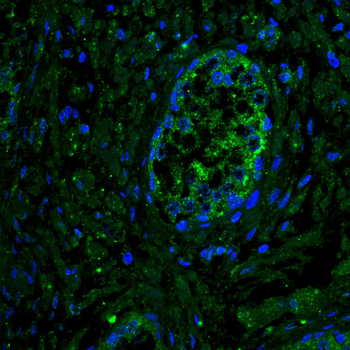 MMP1 Antibody